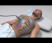 Ultrasound Critical Care