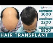 MedLinks Hair Transplants