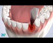 7x7 Dental Implant u0026 Oral Surgery Specialists