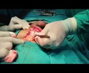 Dr. Souvik Adhikari MCh ( Plastic Surgery)
