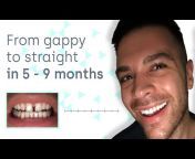 Straight Teeth Direct
