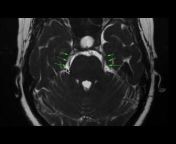 Radiology Case Videos