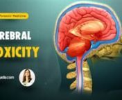 Dr. Hina khan starts this cerebral toxicity video lecture with the explanation of drugs acting on central Nervous System. This cerebral toxicity video lecture explains all the details about sedatives and hypnotics, chloral hydrate, Opioids, Opium and morphine, and Heroine.nn-------------------------------------------------------------nLecture Duration - 00:41:22nRelease Date - February 2020nnWatch complete lecture on sqadia.com -nhttps://www.sqadia.com/programs/cerebral-toxicitynnForensic Medici