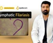 This Lymphatic Filariasis infectious medicine lecture focuses on the definition, Pathology, clinical features, diagnosis, laboratory findings and treatment of the Lymphatic Filariasis. This infectious video lecture is the part of sqadia.com series of Infectious Medicine Lectures. Dr. Dewan Ojla made this lymphatic filariasis student lecture very handy.nn-------------------------------------------------------------nLecture Duration - 00:42:44nRelease Date - January 2020nnWatch complete lecture on