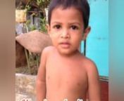 *icare Foundation, Bangalore*nnRef:MA-19092019-41nn*Emergency medical aid Appeal*nnRedom Deb a 4 year old boy son of Sumon Deb and Gita Rani is suffering from eye cancer.nnThe boy is Admitted in Kidwai Cancer Hospital, Bangalore, the family is all the way from Bangladesh. nnThey are in the hospital from the past 1 year. nnHis left eye socket is completely removed.nnThe family is from very poor and needy background. nn*Every month they have expenses of Rs 50,000/-*nnAny brothers and sisters willi