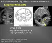UCSF Radiologist Dr. Goldstein and UCSF Surgeon Dr Lee go over the details of congenital diaphragmatic hernias and how they identified different diagnosis and possible treatments.nnThe following program contains graphic images and discussion of medical procedures. Viewer discretion is advised.