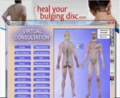Visit http://www.healyourbulgingdisc.com to learn more about Bulging Discs.nnIn this video, Dr. Ron Daulton, Jr. discusses what a bulging disc is, the symptoms that can develop, and the treatments that are available.A bulging disc is also commonly referred to as a protruding disc or a slipped disc.nnhttp://www.youtube.com/watch?v=jssNVsWFEcg