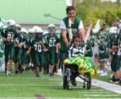 Ten-year-old Deven Jackson has inspired his family, friends and community in Perry County and all across the nation.Life dealt him a hard hand and he took the fight.nnIn 2012 Deven was diagnosed with bacterial meningitis and had both of his legs amputated below the knee.Once an all-star football player, Deven was now sitting the bench and about to begin a much greater battle than any he had on the field.nnDeven’s mother, Michelle Jackson, said that their family had to “learn a new way to