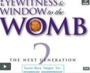 EYEWITNESS &amp; WINDOW to the Womb 2... The Next GenerationnPregnancy Care and Counseling Versionn nPregnancy Centers across the nation have used Sonographer, Shari Richard’s incredible 1990 edition of Eyewitness to the Earliest Days of Life and Window to the Womb to educate their clients on life in the womb and facts on abortion. Now through the new release of Eyewitness &amp; Window to the Womb 2:The Pregnancy Care and Counseling version, pregnancy centers, churches and schools will be ab