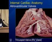 VT 2015 - Session I -Samuel Asirvatham - Anatomy of Substrate for VT in Structural Heart Disease from heart anatomy