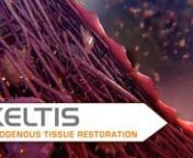 Animation demonstrating how Xeltis’ heart valves enable the patient’s own body to naturally restore a new heart valve through a therapeutic approach called Endogenous Tissue Restoration (ETR). With ETR, the patient’s natural healing system develops tissue that pervades Xeltis’ heart valve, forming a new, natural and fully functional valve within it. As ETR occurs, Xeltis implants are gradually absorbed by the body. ETR is enabled by bioabsorbable polymers based on Nobel prize awarded sci