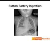 Button Battery Ingestion with Debnath Chatterjee