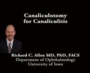 This is Richard Allen at the University of Iowa.This video demonstrates incision and drainage of the canaliculi in a patient with chronic discharge and presumed canaliculitis.The patient has a history of exposure keratopathy, status post lateral tarsorrhaphy and placement of upper and lower punctal plugs.Westcott scissors are used to make an incision along the length of canaliculus of the lower lid.Cotton tip applicators are then used to express the stone in the canaliculus.A chalazion