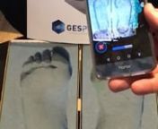 Footscan3D est une application sur téléphone portable optimisée pour les podologues et les professionnels de la santé du pied. Grâce à cette app et sur le CPU et en la caméra du téléphone, nous sommes capable de reconstruire en 3D la voute plantaire du patient afin de la traiter dans une environnement CFAO.