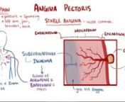 Angina - Osmosis from angina