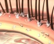 Demodex blepharitis is caused by infestation of Demodex mites, the most common ectoparasite found on humans. There are two species of Demodex—folliculorum and brevis—that live on the skin of the face and eyelids.