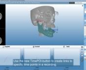 Planmeca Romexis version 4.6 introduces new handy features for Planmeca 4D Jaw Motion system. n© Planmeca Oy www.planmeca.com