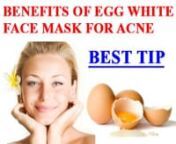 Benefits of Egg White Face Mask for Acne [BEST TIP].- https://www.youtube.com/watch?v=7DTAXvHs0T8nnFollow this method to notice a great difference in your skin&#39;s complexion.nnThis method helps oily skin, reduces redness and swelling.nnDo this about 3 to 4 times a week and You&#39;ll likely notice a great difference in your skin&#39;s complexion.nnnegg white face mask whiteningnegg white face mask wrinklesnegg white face mask worknegg white face mask usesnegg white face mask youtubenbenefits using egg wh