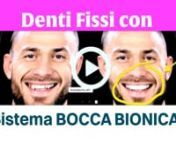 Denti Fissi sistema Bocca Bionica from bocca