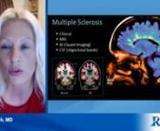 Neuroradiologists Dr. Suzie Bash of Radnet reviews the new NeuroQuant MS quantitative imaging report and its use in the diagnosis and treatment of multiple sclerosis. Dr. Bash is a current user of NeuroQuant and has been using it in her clinical practice for over 15 years. nnThis clip was part of an hour-long webinar hosted by RSNA and a panel of experts discussing the role of imaging and the use of automated volumetric post-processing for the diagnosis and longitudinal assessment of multiple sc