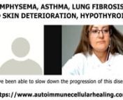 In our program, our client has shared the progress he has made with lung fibrosis: “My normal oxygen never drops below 89 and before it was dropping to 83. In terms of my energy, I don’t have crushes I would have from eating a big heavy meal.”nn“This is a pure genetic case where my lungs are being destroyed genetically. I definitely feel like that I have been able to slow down and make the progression of disease better with this nutrition.”nn“As long as I can keep my lungs stable and