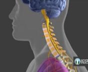 This animation depicts a forward head posture and its effect on the curvature of the cervical spine, leading to diminished nerve energy / flow to the rest of the body. Untreated by a chiropractor specializing in corrective care, it can effect not only the limbs, but more importantly internal organs - leading to disease.