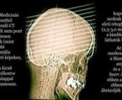 Hogy néz ki a fejünk belülről? Hogyan lehet felvételt készíteni róla? Hogyan készül egy újmedicinás CT?(oktatóvideó) Ha a videót elég sokszor megnézed, az agyad rögzíti a látottakat, és 3D-ben megtanulod mi hol van. Az agyi relék elhelyezkedését a Szerv Atlasz ún.