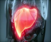 10 Signs of a Dying Liver(End Stage Liver Disease) from liver disease causes diarrhea